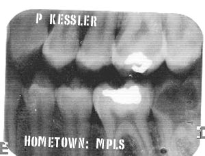 Pat Kessler's Dental Records?